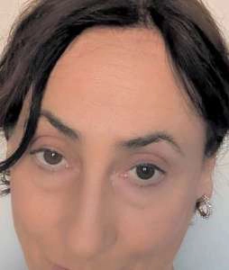 אלה
